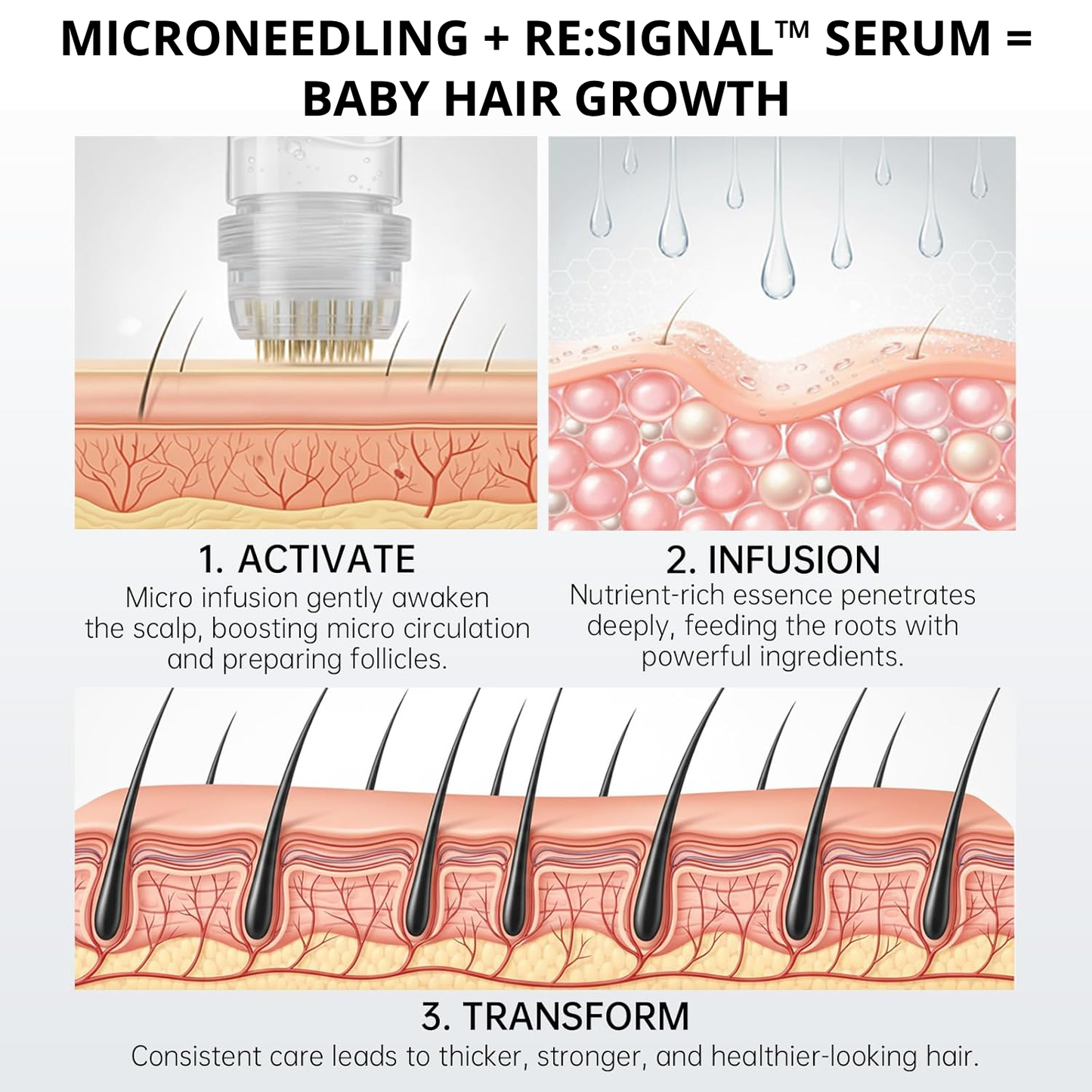 Myrix Follicle Awakening System™