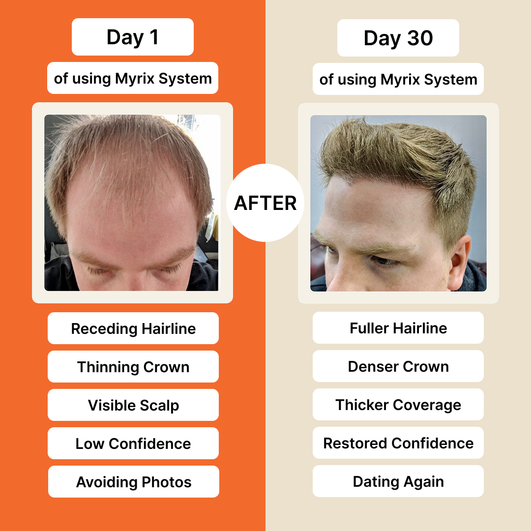 Myrix Follicle Awakening System™