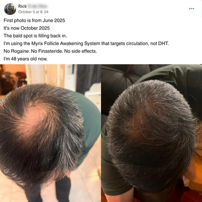 Myrix Follicle Awakening System™